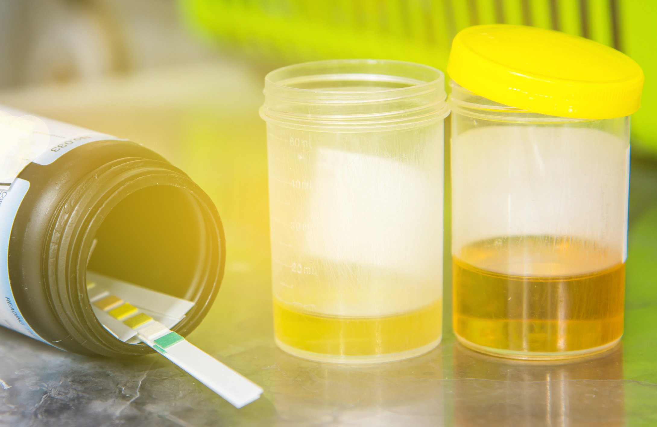 IGNIS Forensics: DNA Testing, Background Checks, Drug Testing, C.S.I.